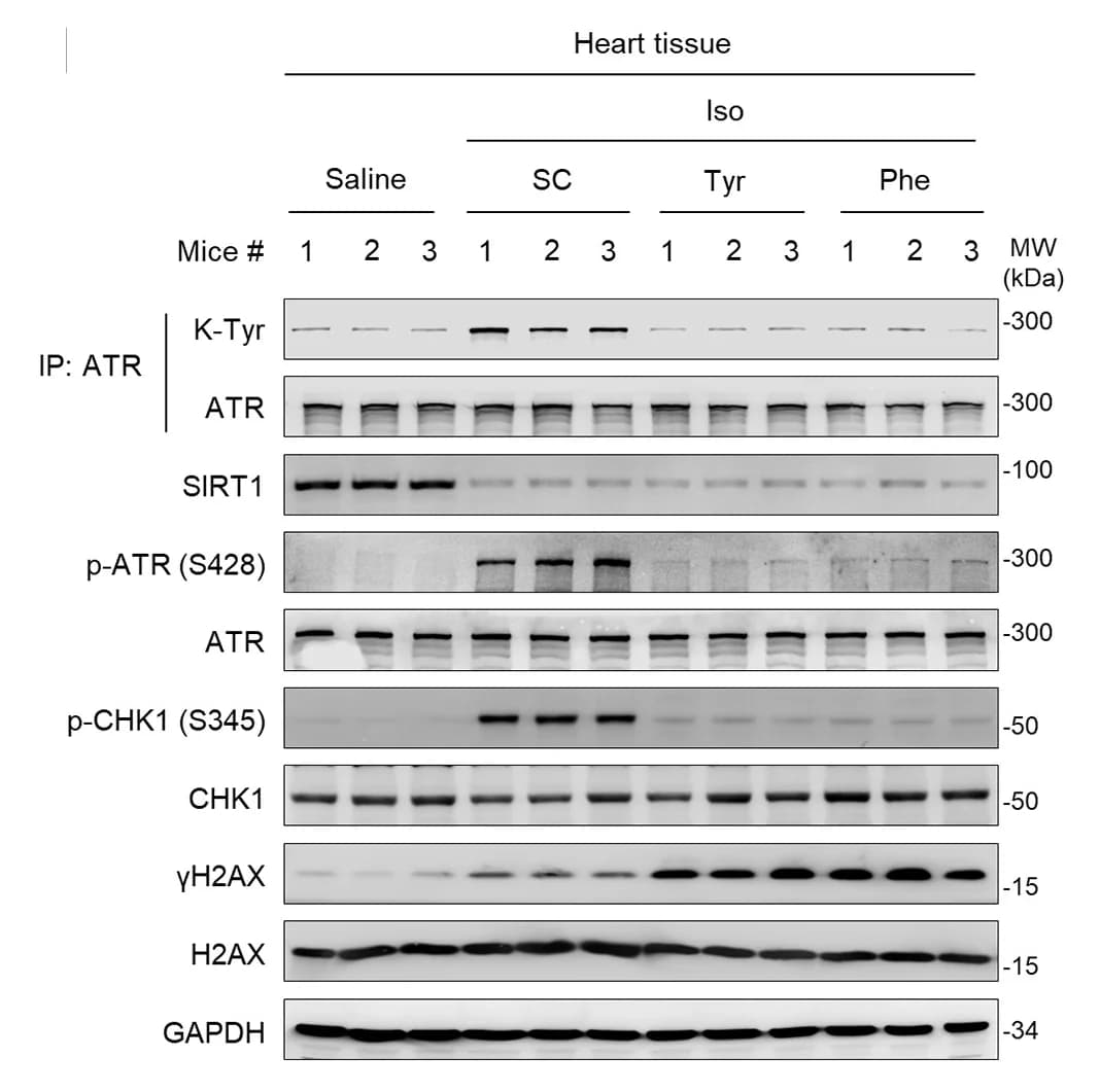 Open access visualization of Gel, Western Blot, ATR, p-ATR, CHK1