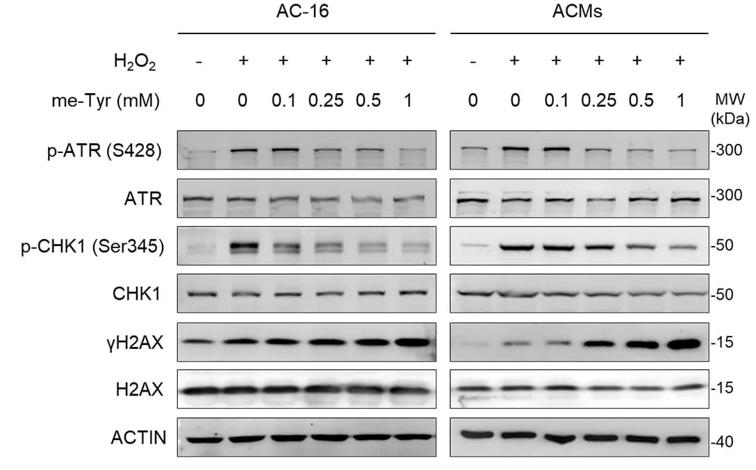 Open access visualization of Gel, ATR-CHK1 Pathway, γH2AX Levels, AC-16 Cells, ACMs