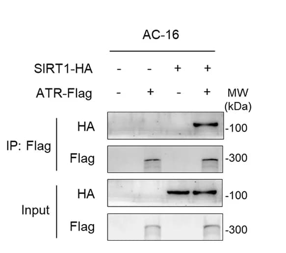 Open access visualization of Gel, Exogenously expressed ATR, Exogenously expressed SIRT1, AC-16 Cells