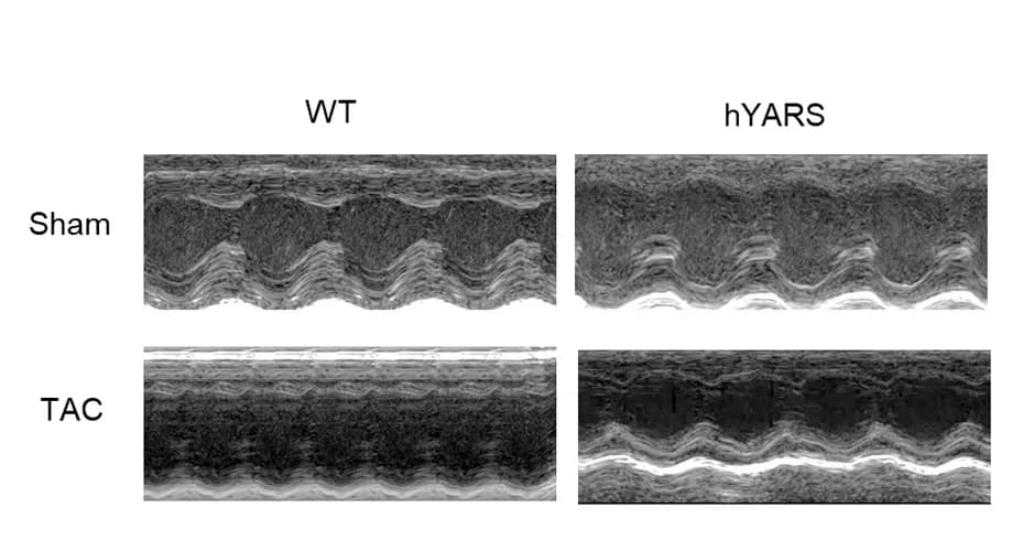 Open access visualization of Microscopy, Echocardiogram, Wild-type mice, hYARS mice