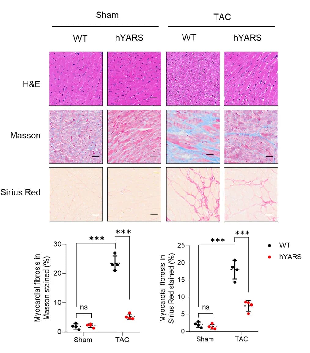 Open access visualization of Microscopy, Scatter Plot, H&E staining, Masson staining, Sirius red staining