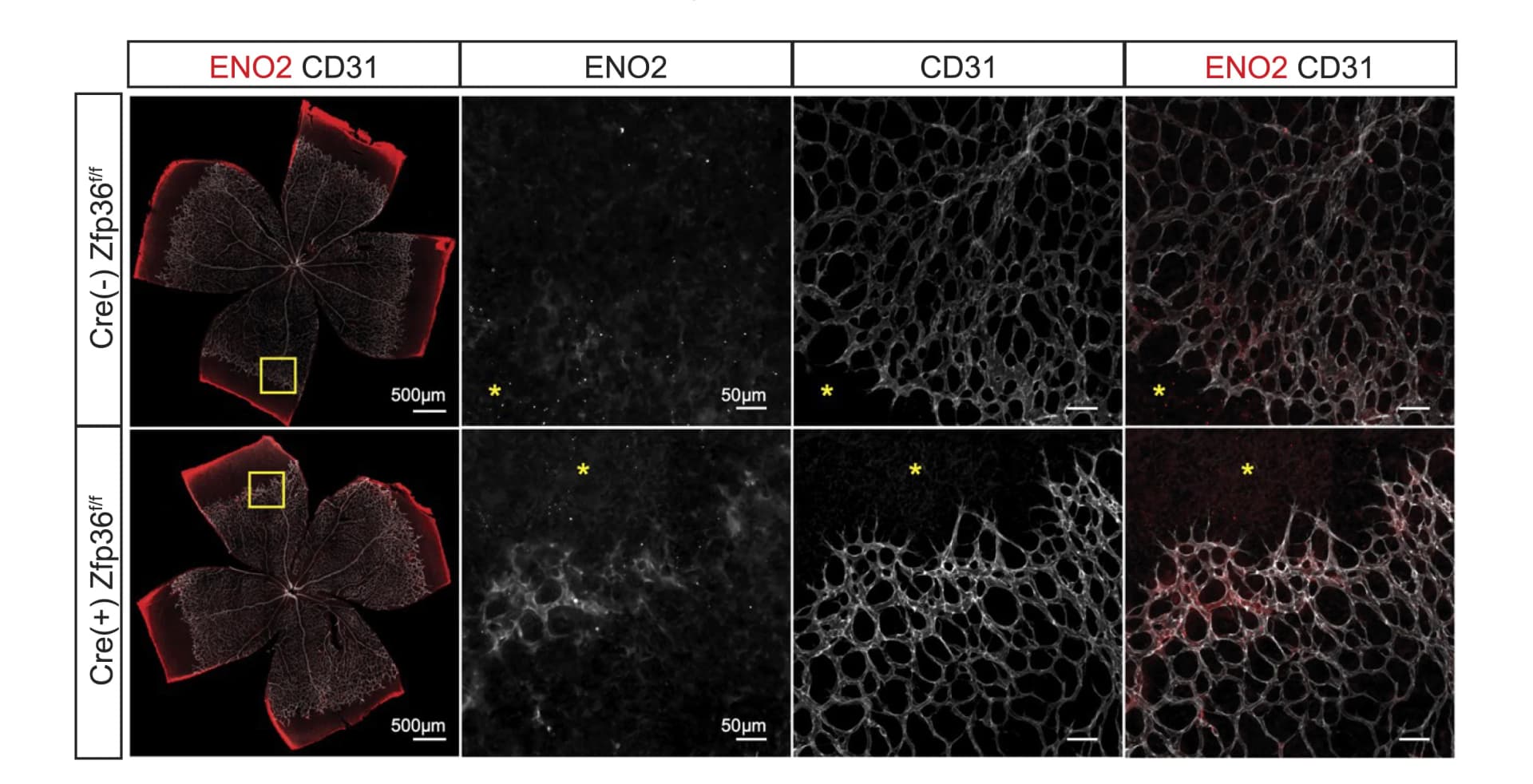 Open access visualization of Microscopy, Photo, Retina, Immunostaining, Endothelial cells