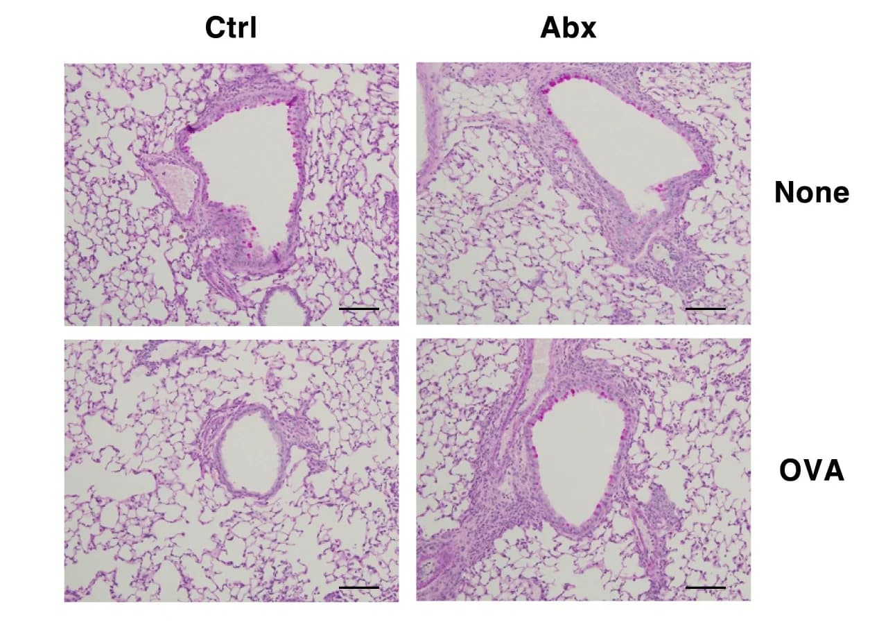 Open access visualization of Microscopy, H&E Sections, PAS Sections, Lung Tissues