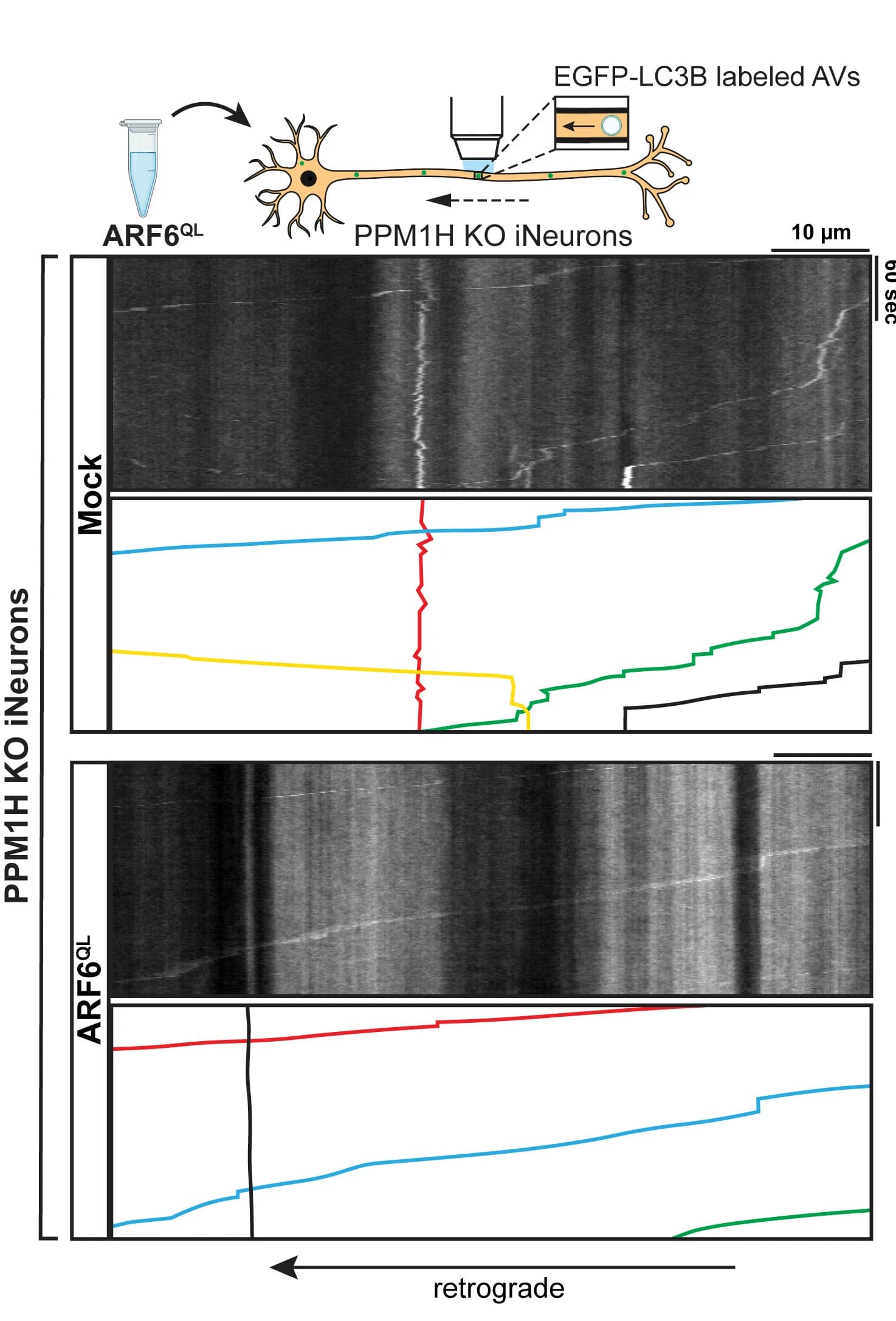 Open access visualization of Line Plot, Microscopy, Kymographs, Axonal Transport, EGFP-LC3 Vesicles