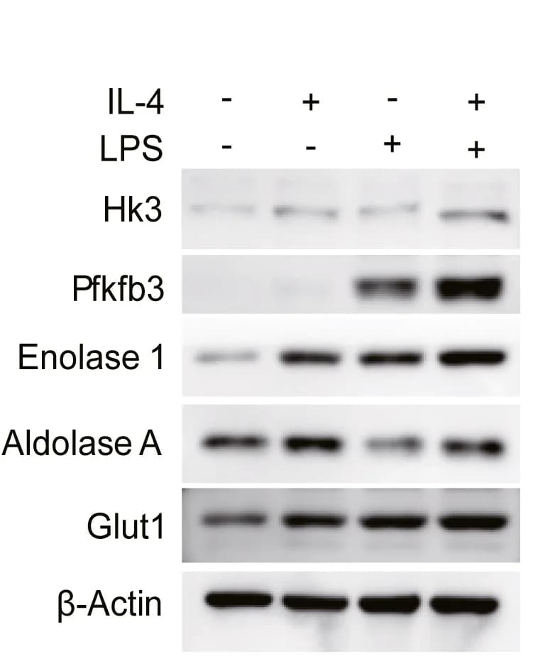Open access visualization of Gel, Western Blot, Glycolytic Enzymes, Glucose Transporter Glut1, Macrophages