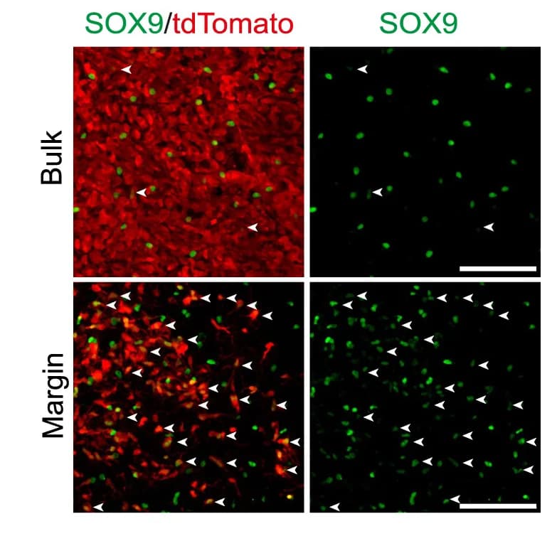 Open access visualization of Microscopy, Immunofluorescence, Bulk Region, Margin Region, EGFR Tumors