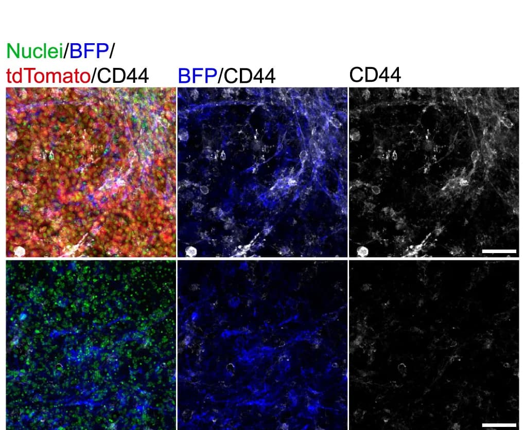 Open access visualization of Microscopy, EdU, CD44, GFAP, tdTomato