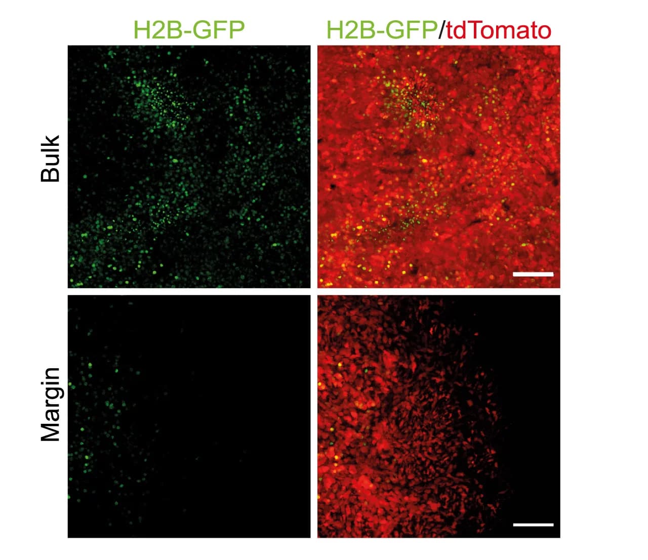 Open access visualization of Microscopy, Fluorescence Images, GFP, tdTomato, Tumor Cells