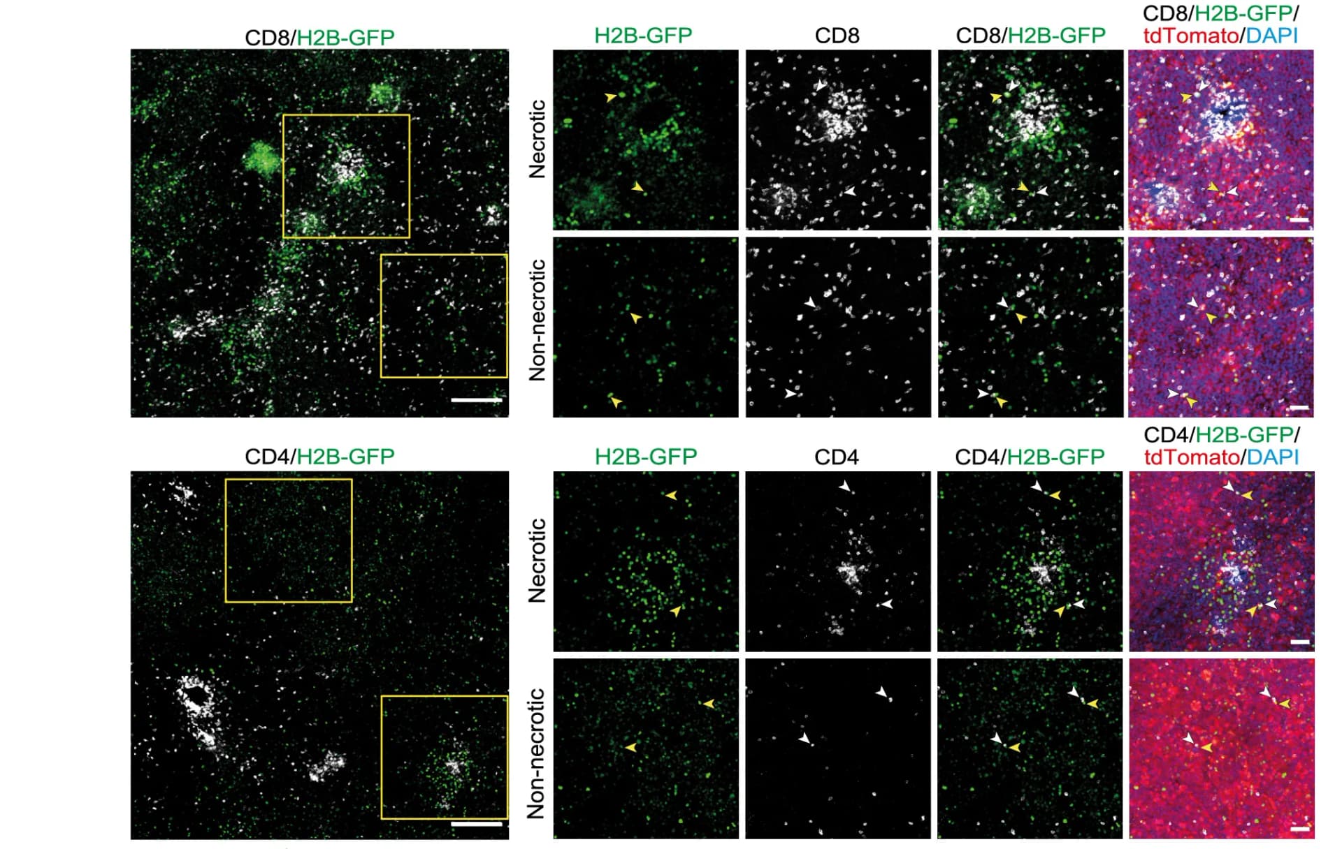 Open access visualization of Microscopy, Immunofluorescence Staining, CD8 T Cells, CD4 T Cells, EGFR-H2B-GFP Tumors