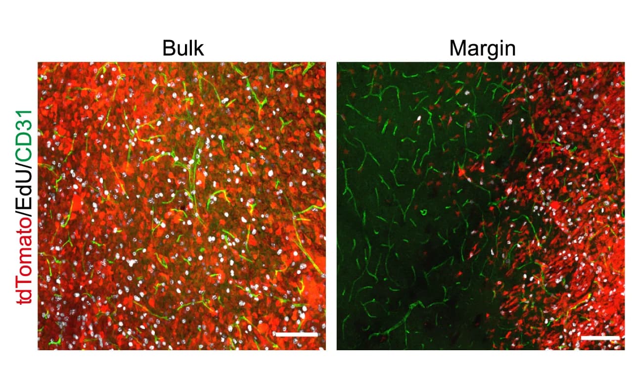 Open access visualization of Microscopy, Immunofluorescence images, EdU+tumor cells, EGFR tumors, Mann-Whitney test