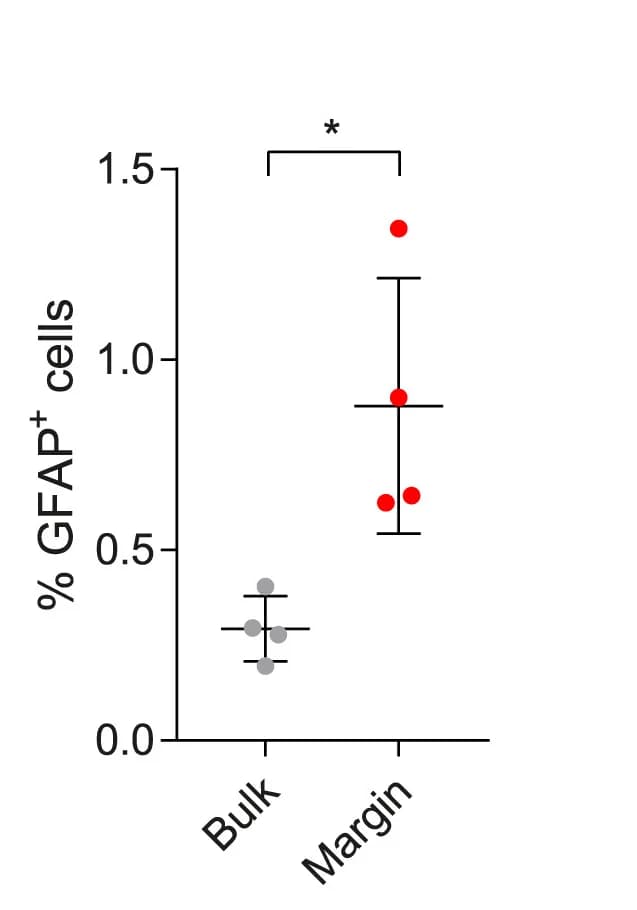 Open access visualization of Scatter Plot, Error Bars, Immunofluorescence images, Differentiated tumor cells, DCX