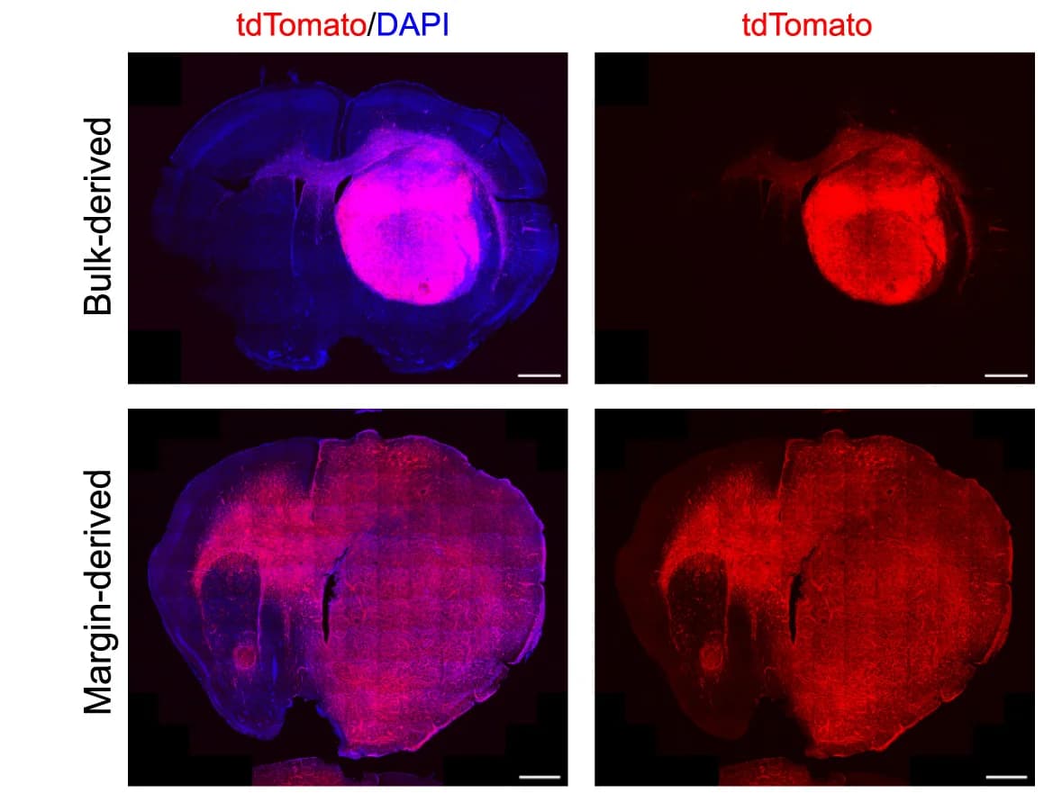 Open access visualization of Microscopy, Immunofluorescence Images, Bulk-Derived Tumors, Margin-Derived Tumors, tdTomato