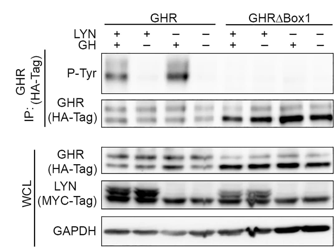 Open access visualization of Gel, Immunoblot, Phosphotyrosine, GHR, HA-tag