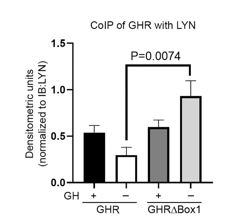 Open access visualization of Bar Plot, Error Bars, Densitometry, LYN interaction, WT GHR