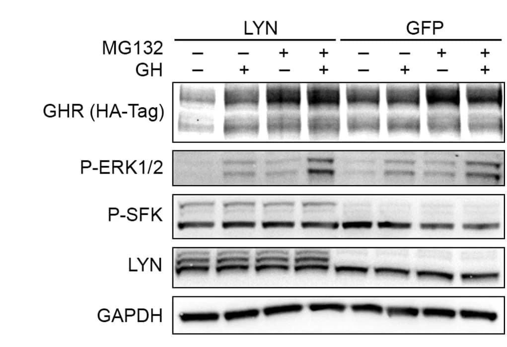 Open access visualization of Gel, Immunoblot, LYN, GFP, HEK293 Cells