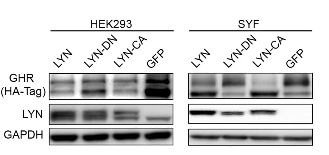 Open access visualization of Gel, Immunoblot, GHR, HEK293 Cells, SYF Cells