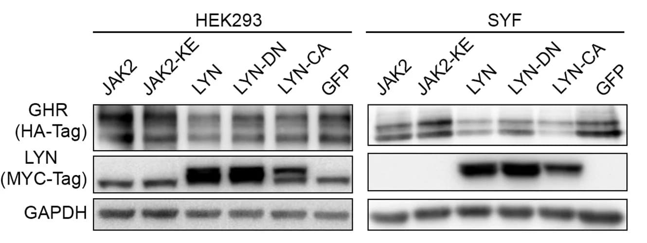 Open access visualization of Gel, Immunoblot, JAK2, LYN, GHR