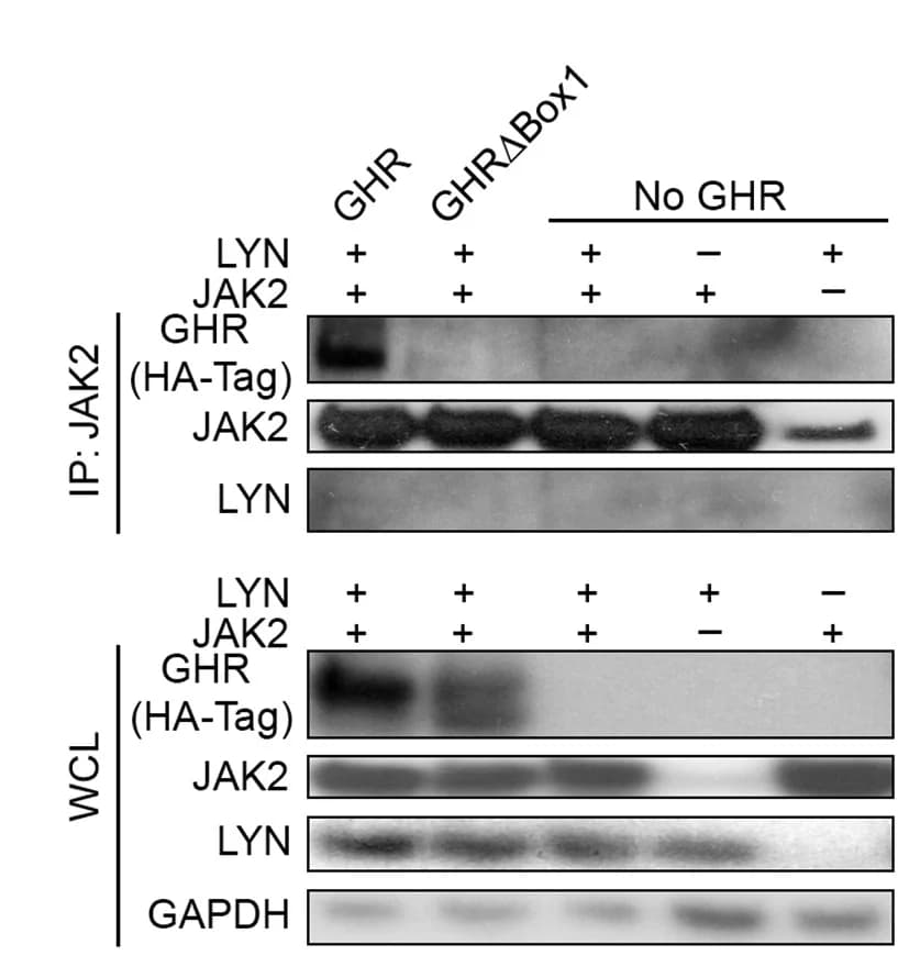 Open access visualization of Gel, Immunoblot, Immunoprecipitation, JAK2, LYN