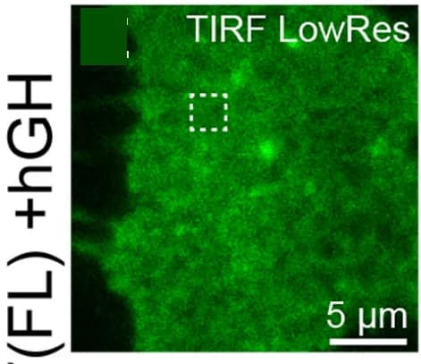 Open access visualization of Microscopy, HEK293 Cells, GHR-WT(FL)-mEOS2, TIRF Image, Diffusion Coefficient