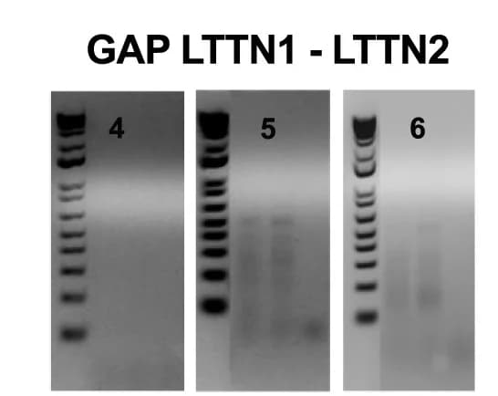 Open access visualization of Gel, LTTN1 mRNA, LTTN2 mRNA, Primers, Gap Validation