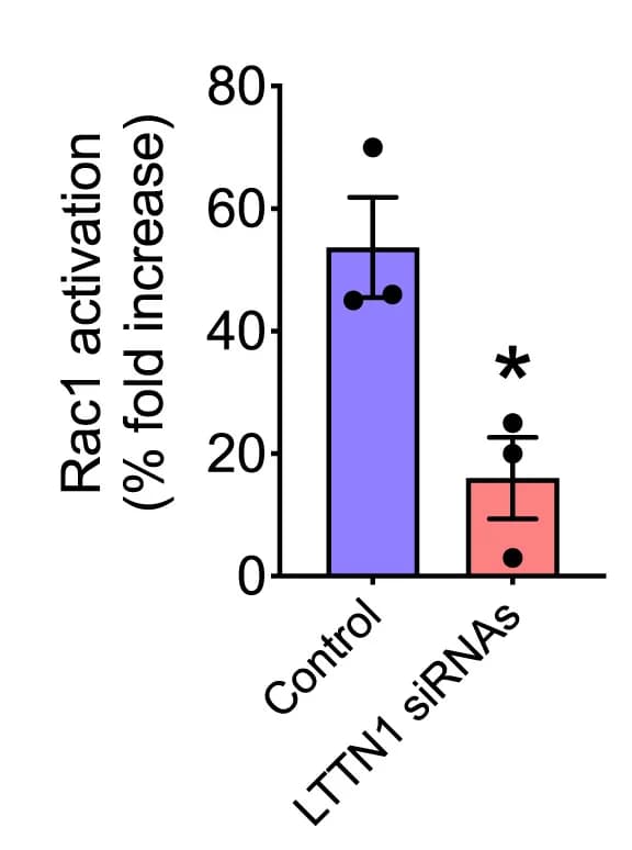 Open access visualization of Bar Plot, Error Bars, G-LISA, Rac1, T Lymphocytes