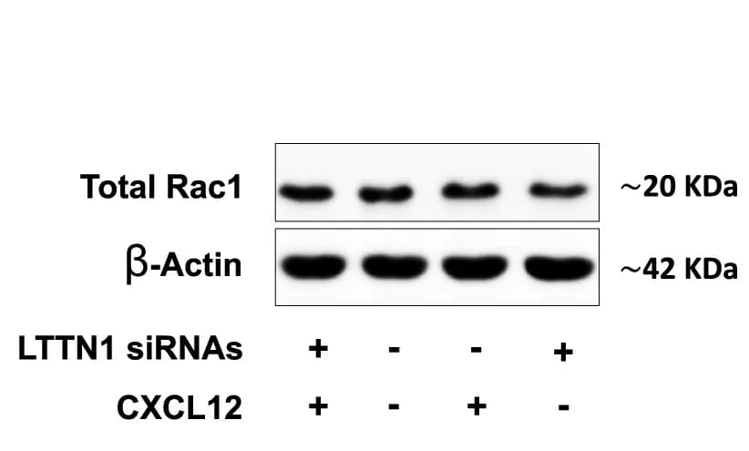 Open access visualization of Gel, Immunoblot, Rac1, T Lymphocytes, siRNAs