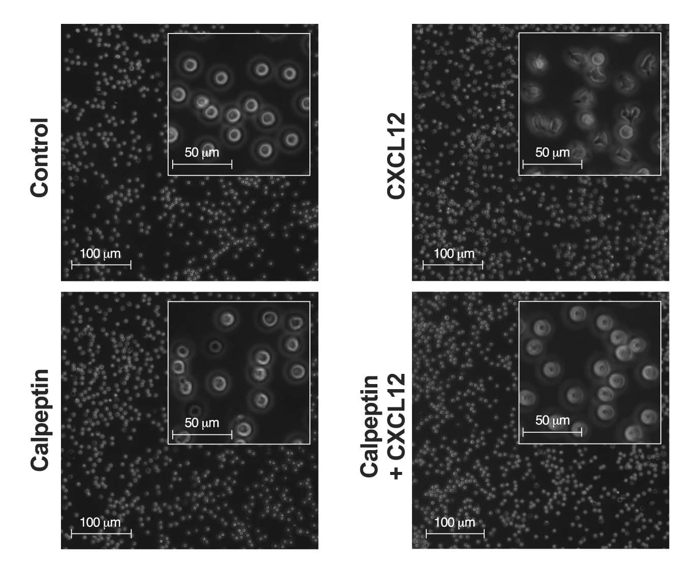 Open access visualization of Microscopy, T Lymphocyte Polarization, CXCL12 Stimulation, Calpeptin Pre-treatment