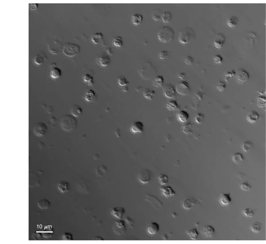 Open access visualization of Microscopy, Differential Interference Contrast, DIC Images, Control, LTTN1-silenced
