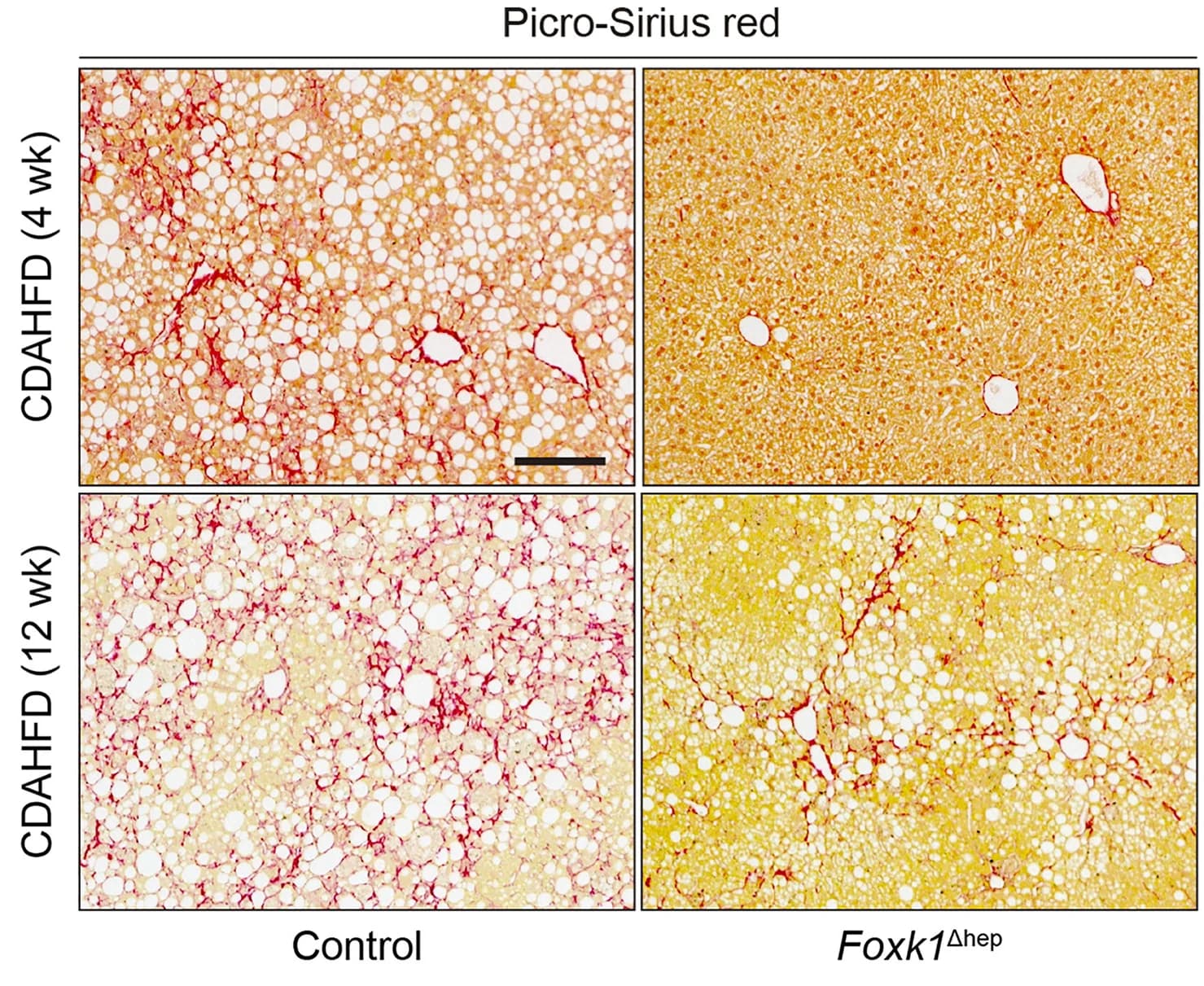 Open access visualization of Microscopy, Liver Sections, Control, Foxk1Δhepmice, CDAHFD