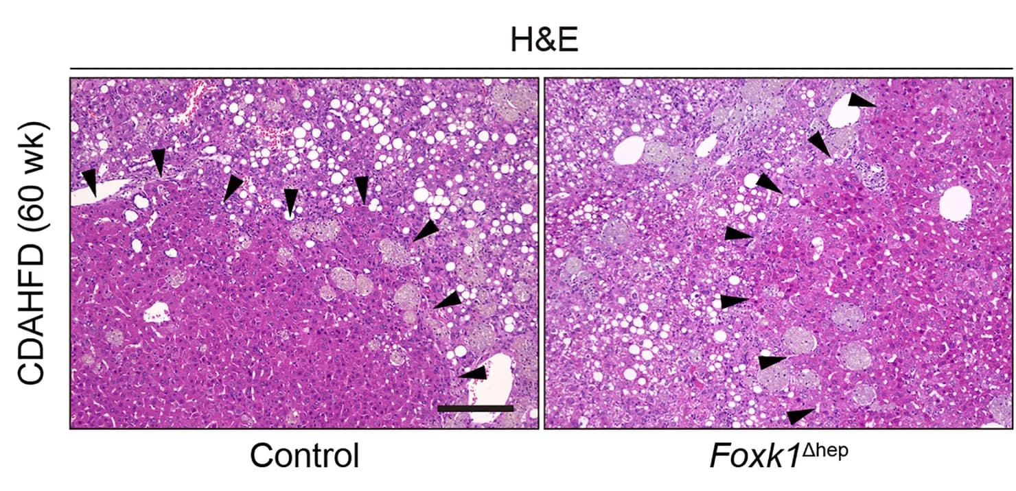 Open access visualization of Microscopy, H&E staining, Liver Sections, Foxk1Δhep mice, CDAHFD model