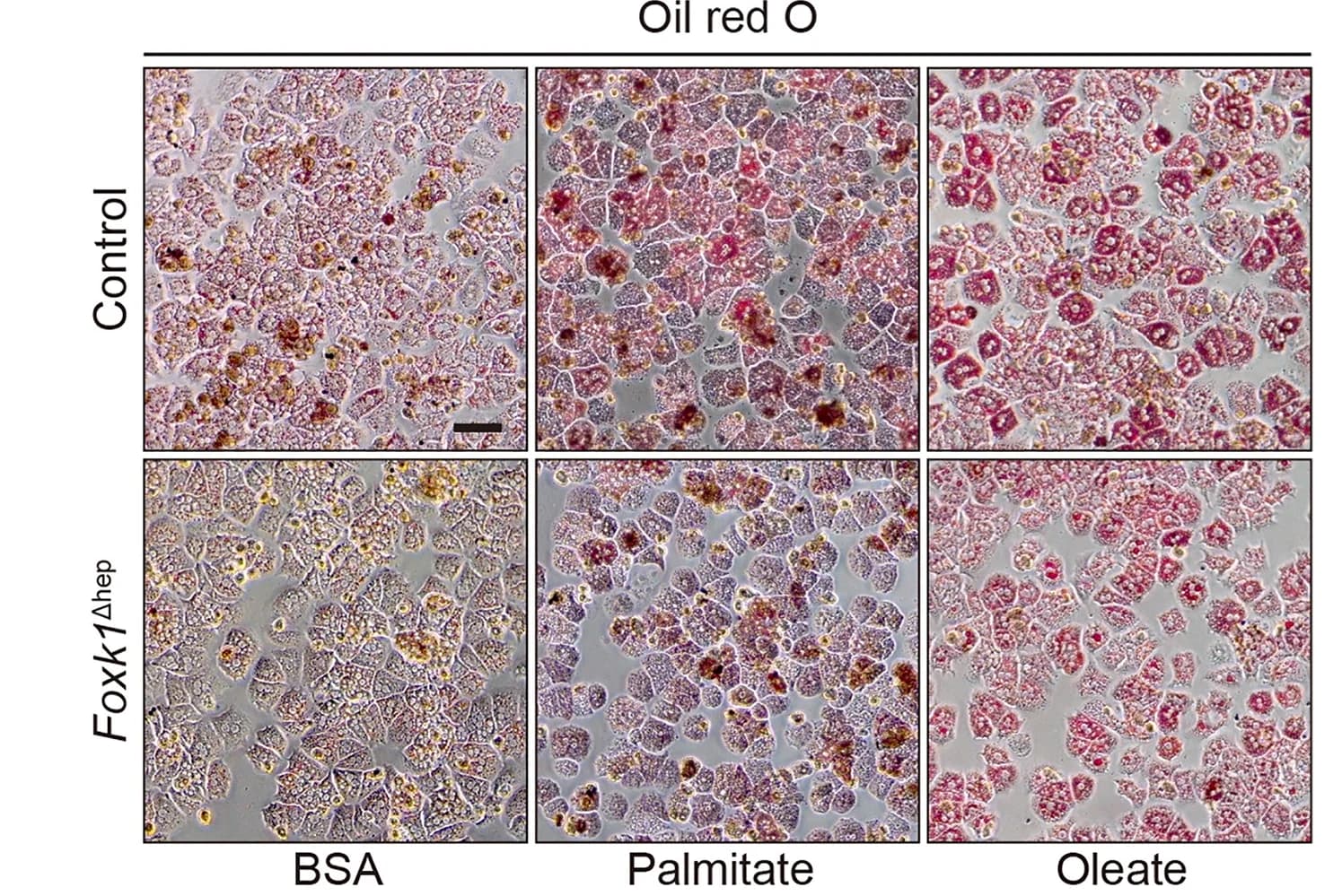 Open access visualization of Microscopy, Hepatocytes, BSA, Palmitate, Oleate