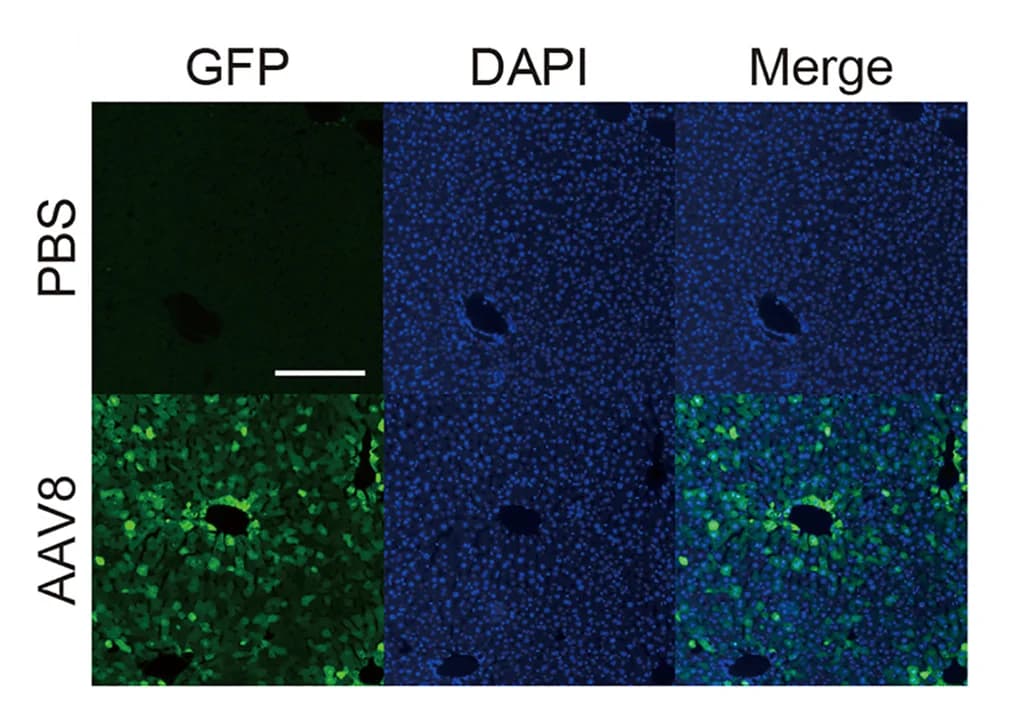 Open access visualization of Microscopy, Fluorescence Microscopy, GFP, Frozen Sections, Mouse Liver
