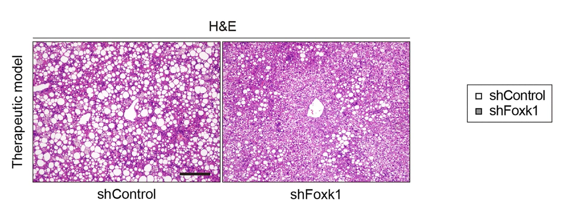 Open access visualization of Microscopy, Liver Sections, shControl Mice, shFoxk1 Mice, Therapeutic Model