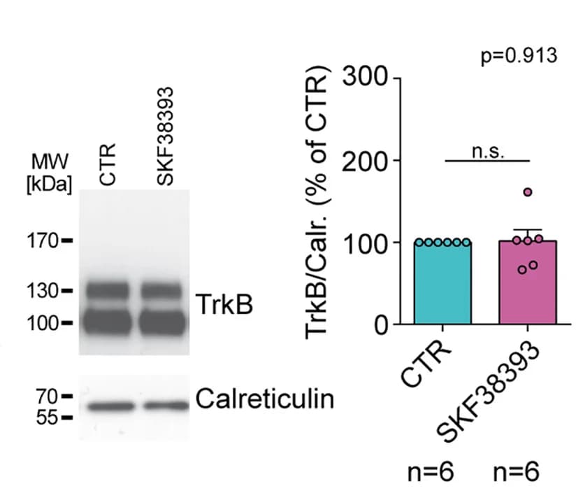 Open access visualization of Bar Plot, Photo, Gel, Western Blot, TrkB Protein