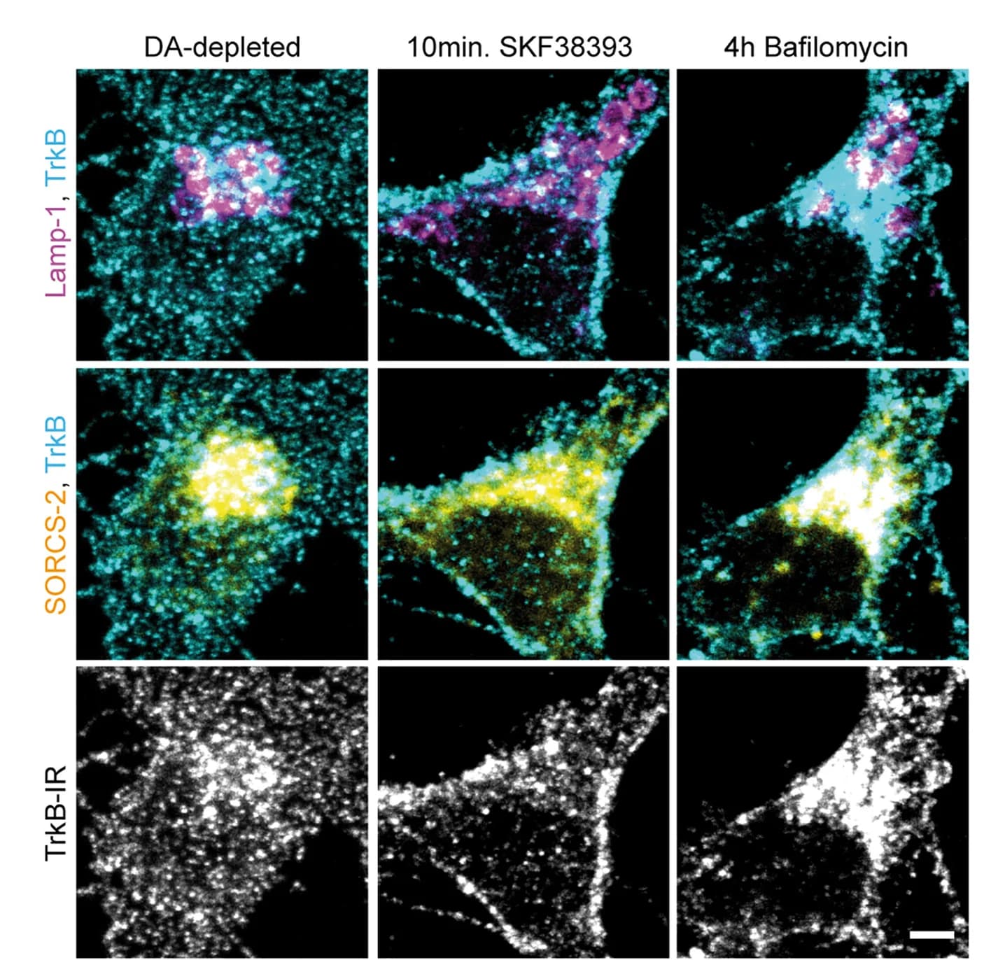 Open access visualization of Microscopy, Confocal Microscopy, Perinuclear TrkB Clusters, Lamp-1-Positive Structures, SORCS-2