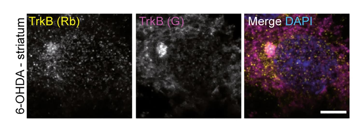 Open access visualization of Microscopy, Identification, Intracellular TrkB Clusters, Antibodies, N Terminus of TrkB