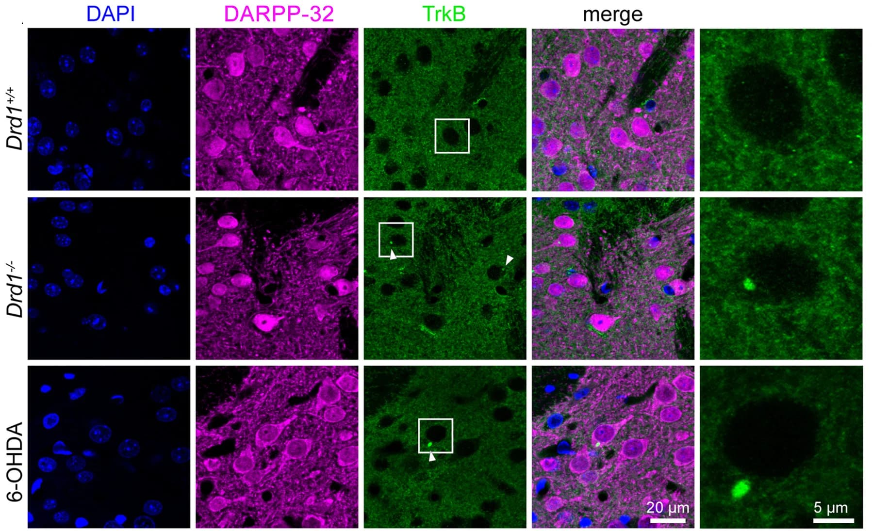 Open access visualization of Microscopy, Confocal Microscopy, TrkB, DARPP-32, Striatal Sections