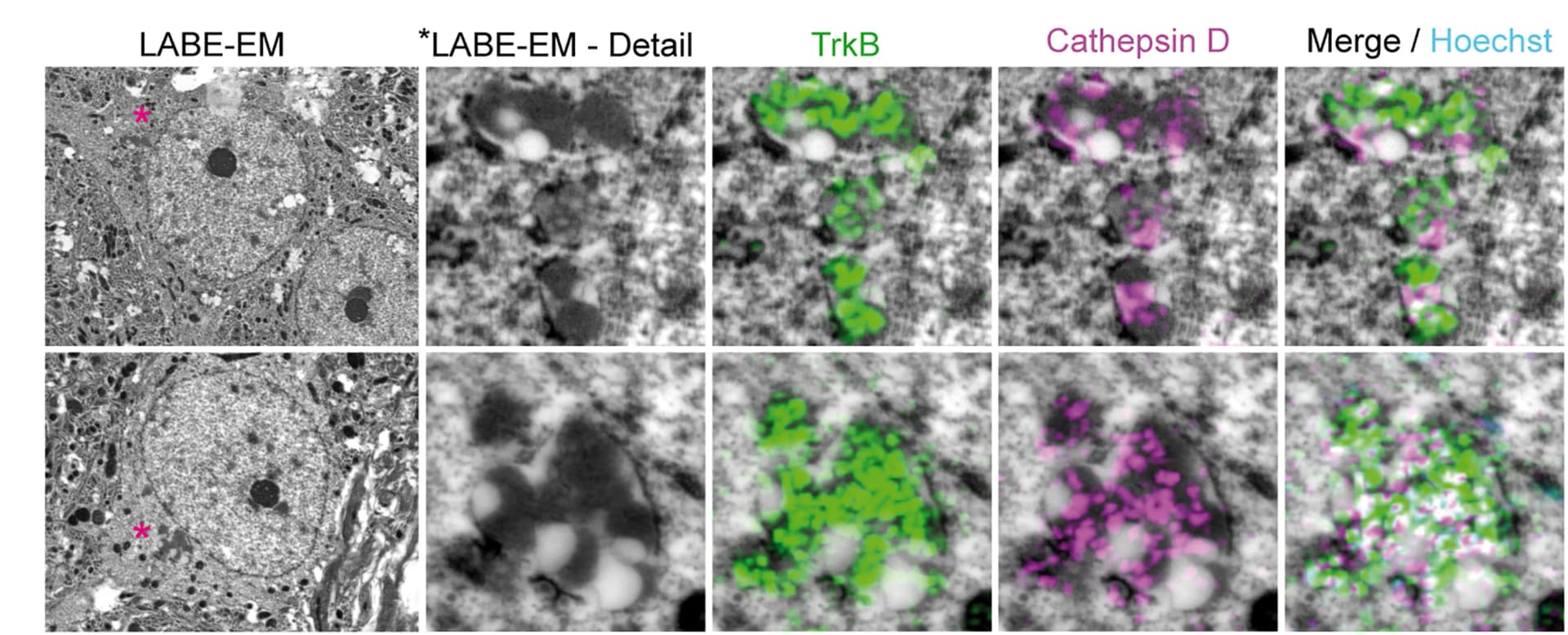 Open access visualization of Microscopy, CLEM, PFA-fixed Vibratome Sections, 6-OHDA Rats, SIM-IHC