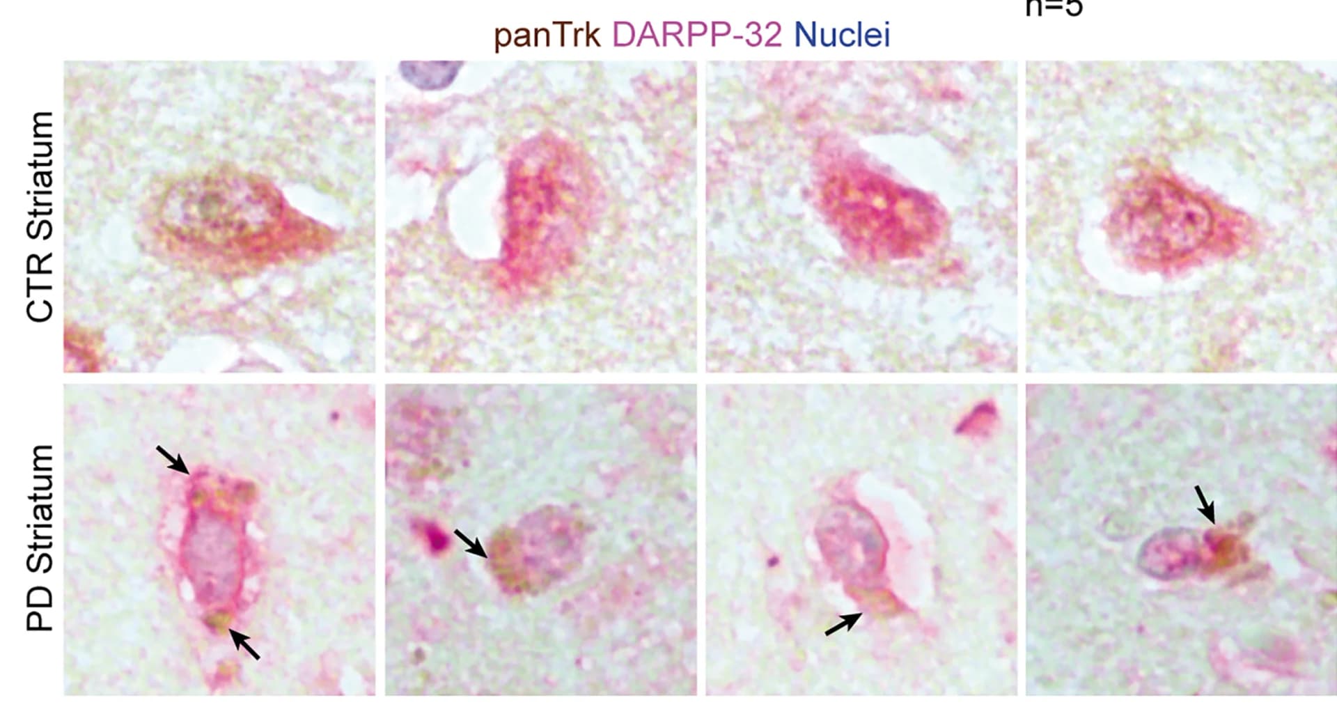 Open access visualization of Microscopy, Pan-Trk, DARPP-32, Alkaline phosphatase, Pan-Trk-cluster