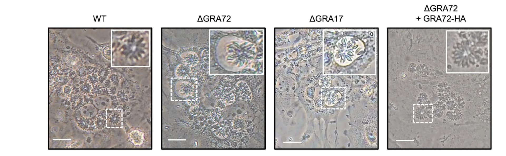Open access visualization of Microscopy, Photo, PV Morphology, Parasites, Phase-Contrast Microscopy