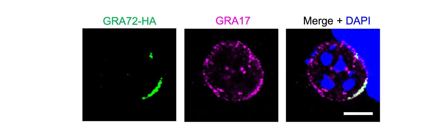 Open access visualization of Microscopy, GRA72-HA Localization, GRA17 Localization, GRA7 Localization, Immunofluorescence Assay