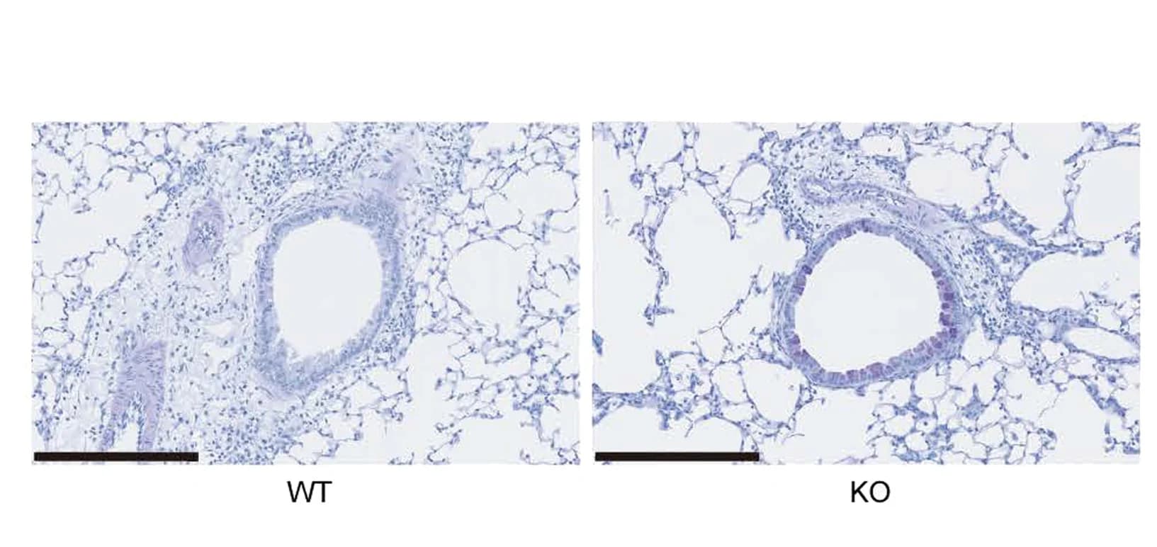 Open access visualization of Microscopy, Photo, Cell Proliferation Assay, ILC2s, Cell Culture