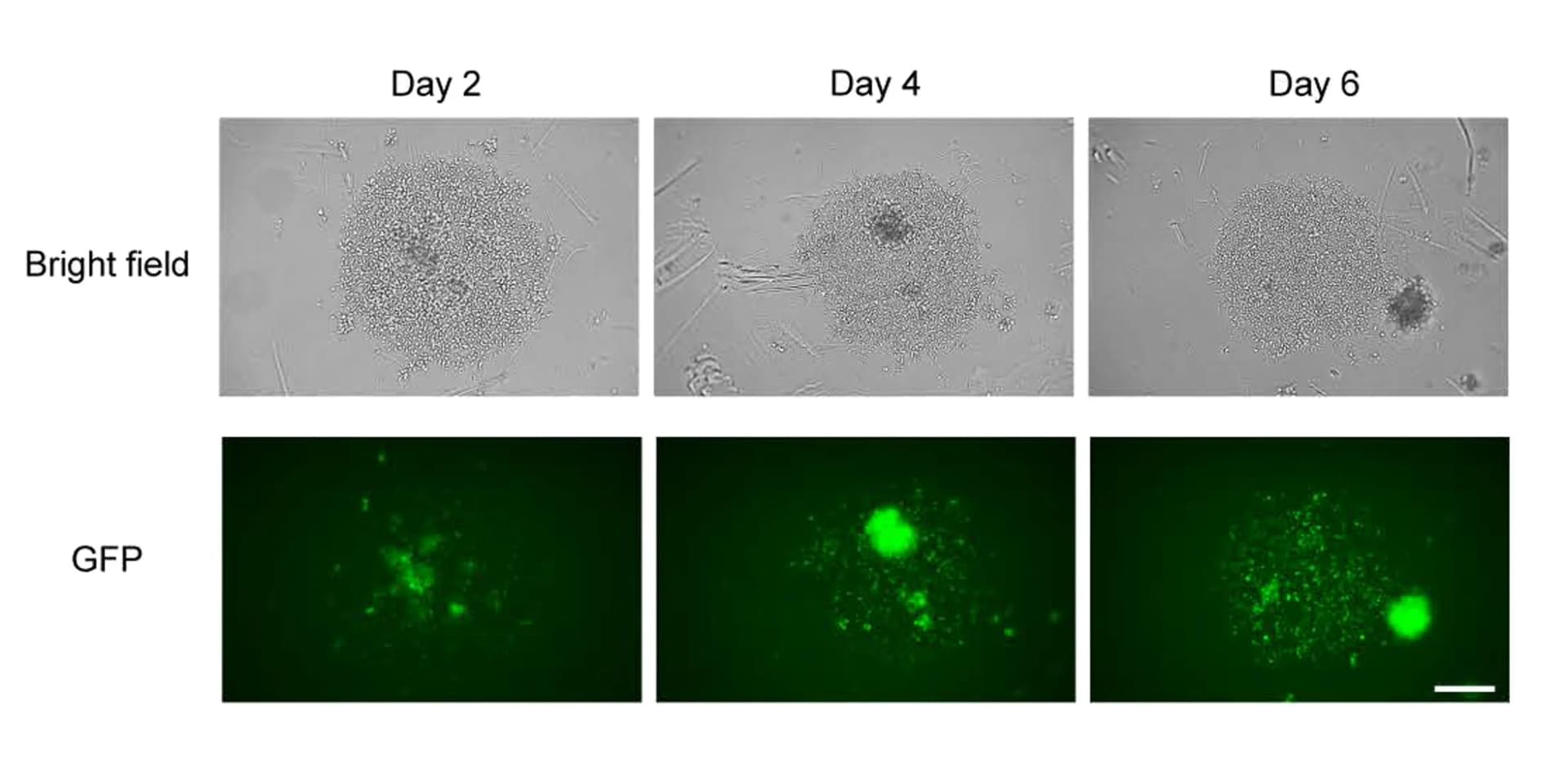 Open access visualization of Microscopy, GFP expression, ILC2s