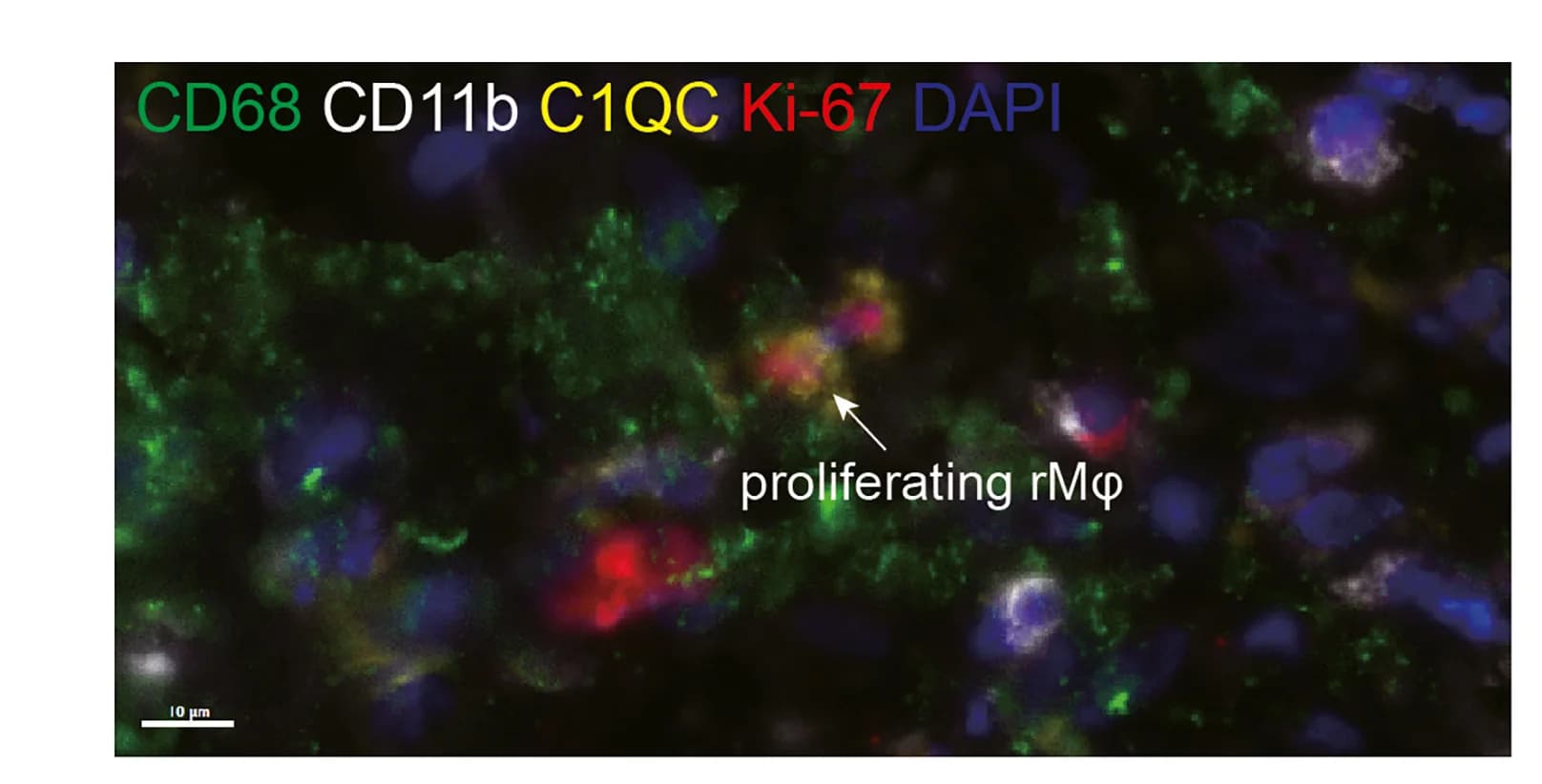Open access visualization of Microscopy, Proliferating rMφ, mIHC, CD68, CD11b