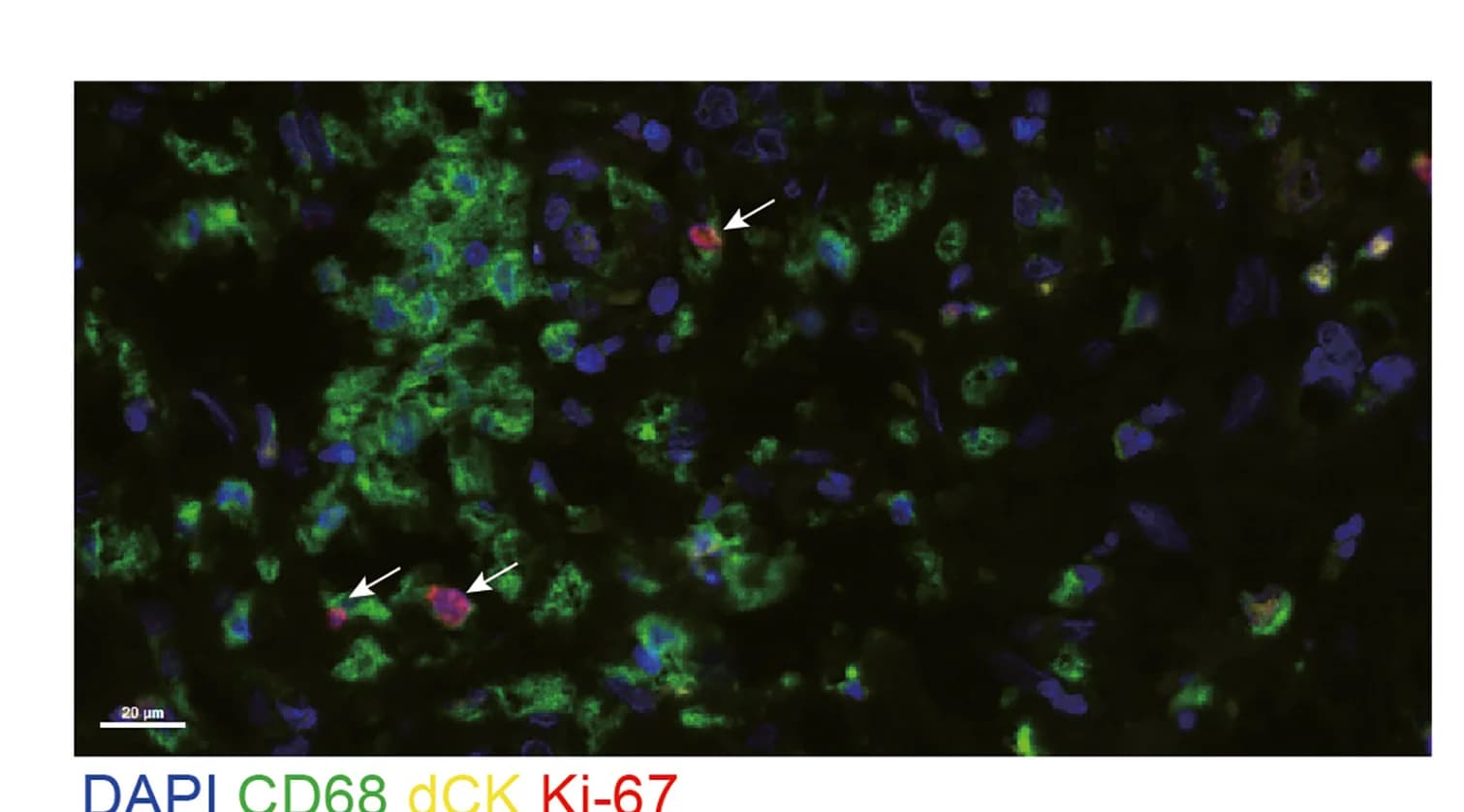 Open access visualization of Microscopy, Multi-Color IHC Images, dCK, Proliferating rMφs, Neutrophils