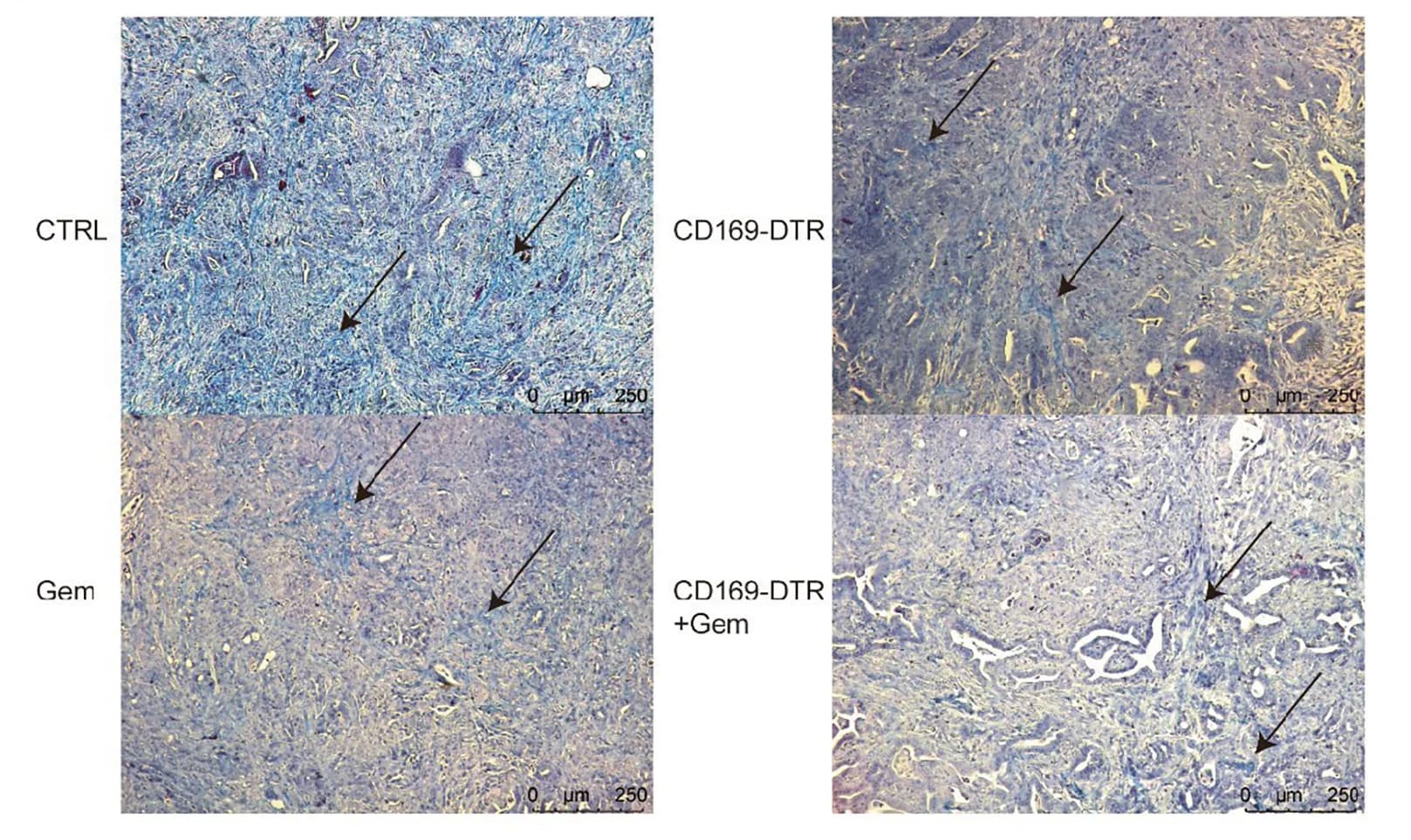 Open access visualization of Microscopy, Masson Staining, Paraffin Sections, Tumor Tissues, Collagen Fibers