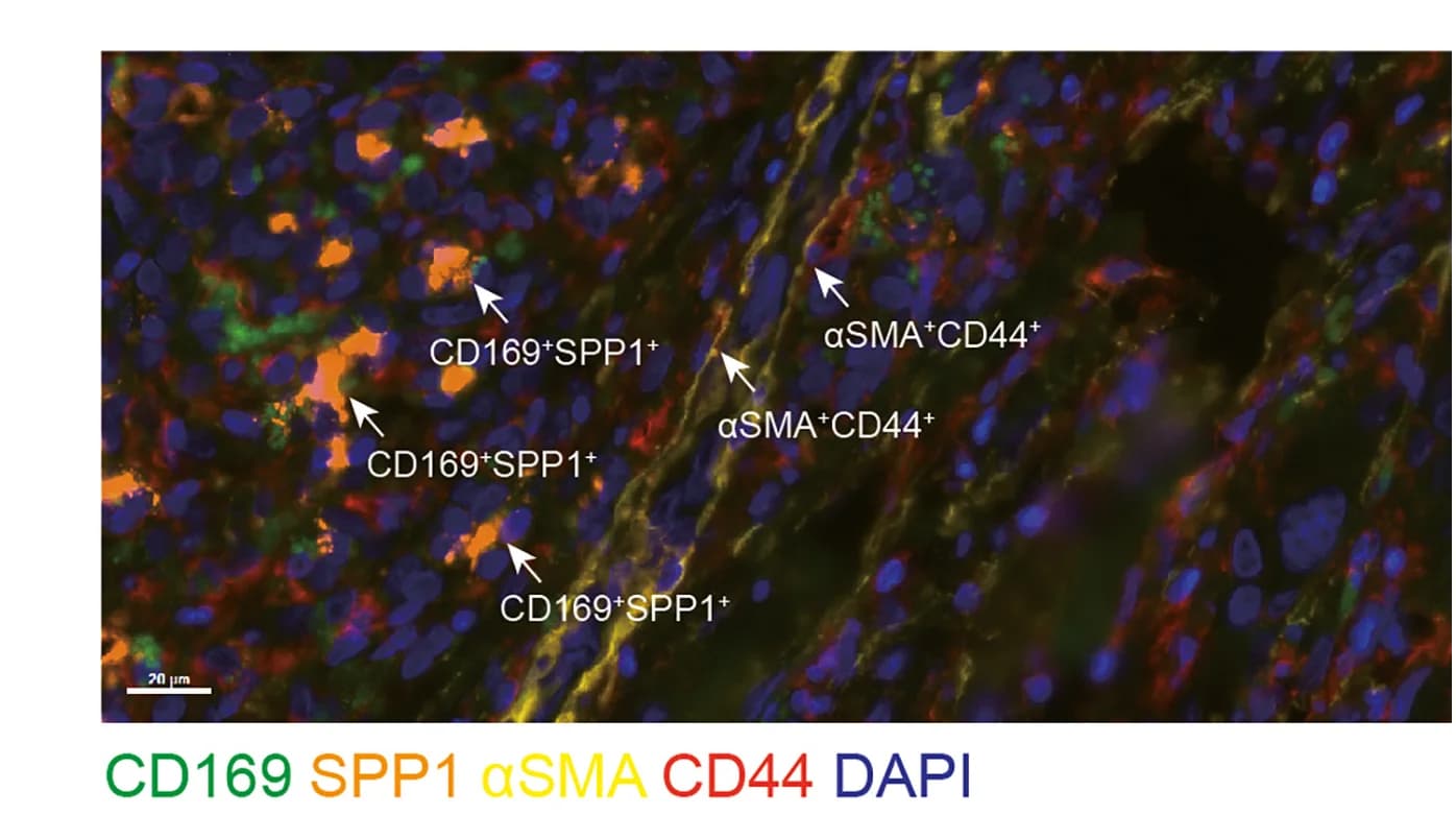 Open access visualization of Microscopy, Multi-Color Image, SPP1+proliferating rMφ, CD44+fibroblast, CD169