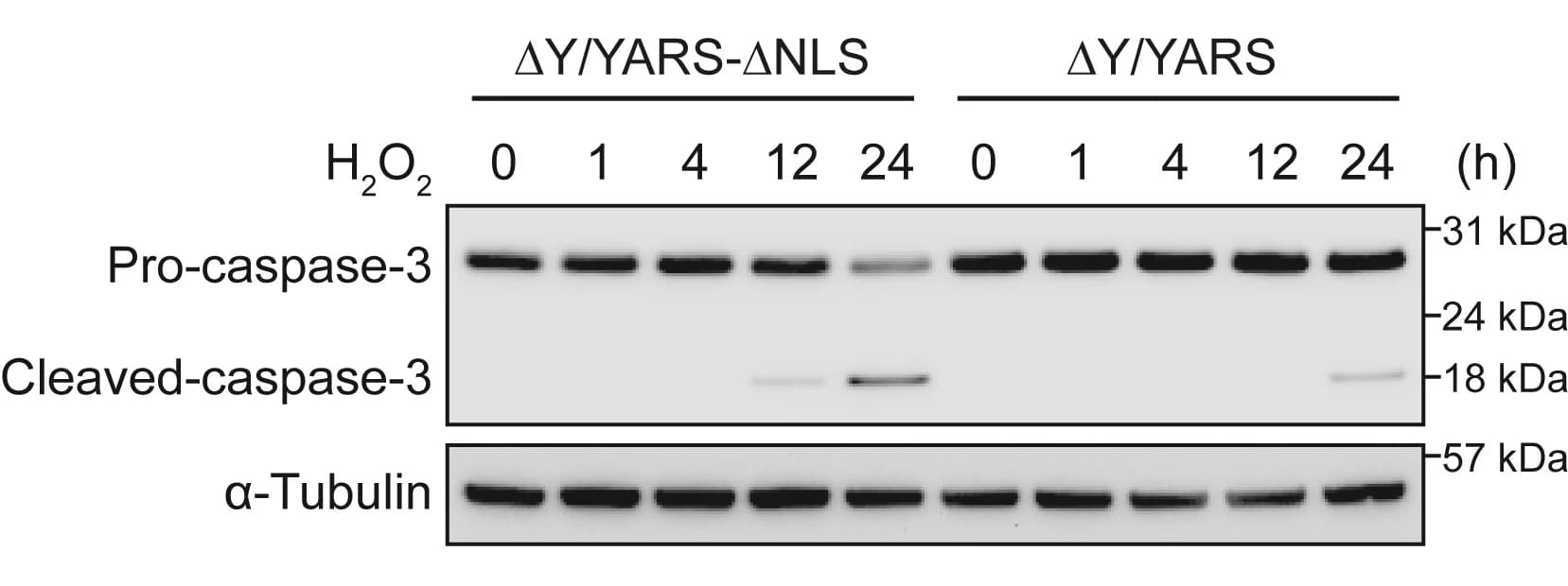 Open access visualization of Gel, Nuclear TyrRS, Apoptosis, Caspase-3 Cleavage, Western Blot