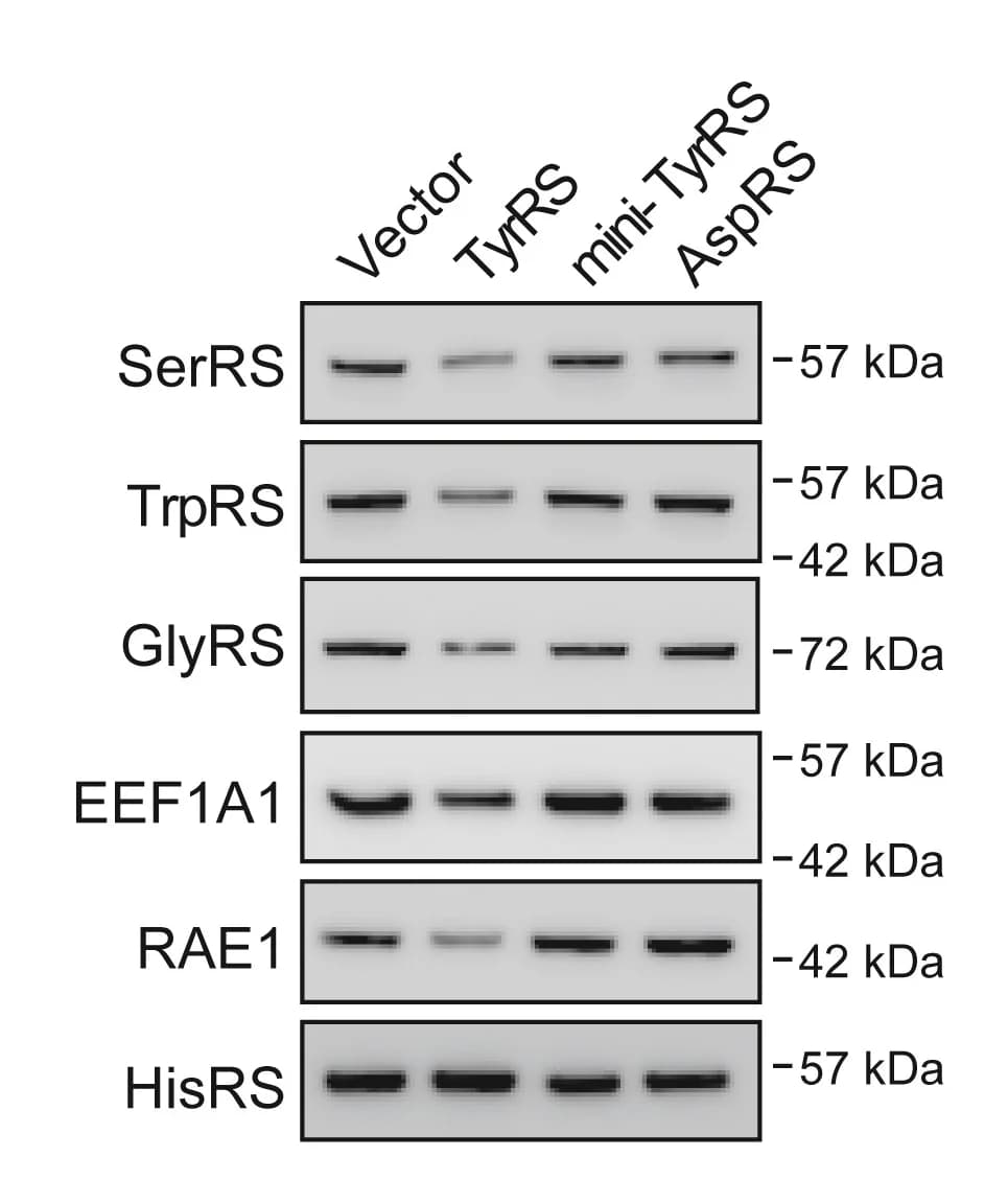 Open access visualization of Gel, TyrRS overexpression, Protein downregulation, Target genes, Western blot