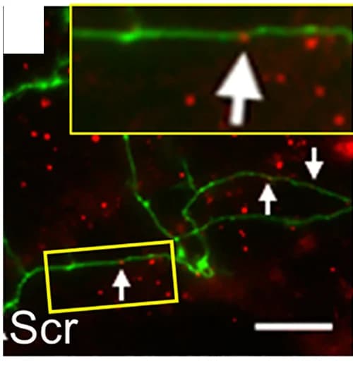 Open access visualization of Microscopy, TMR-dextran loading, Scr neurons, Primary Cultures, CGNs